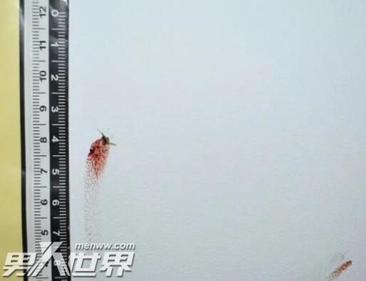 被拍扁的蚊子成了犯罪“目击证人”